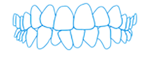 Show crowded teeth malocclusion