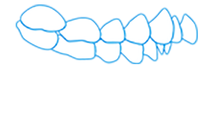 Show protrusion malocclusion